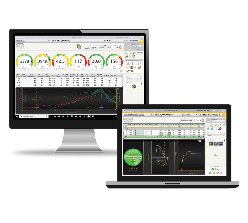 MGC Diagnostics: Ascent&nbsp;Software