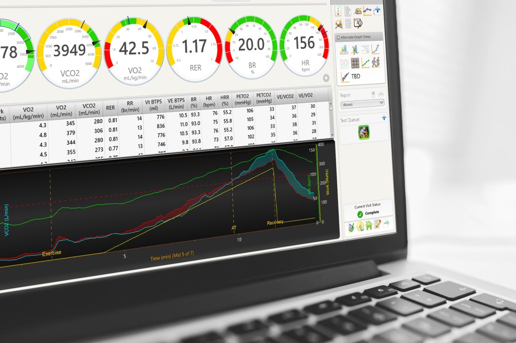MGC Diagnostics: Ascent&nbsp;Software